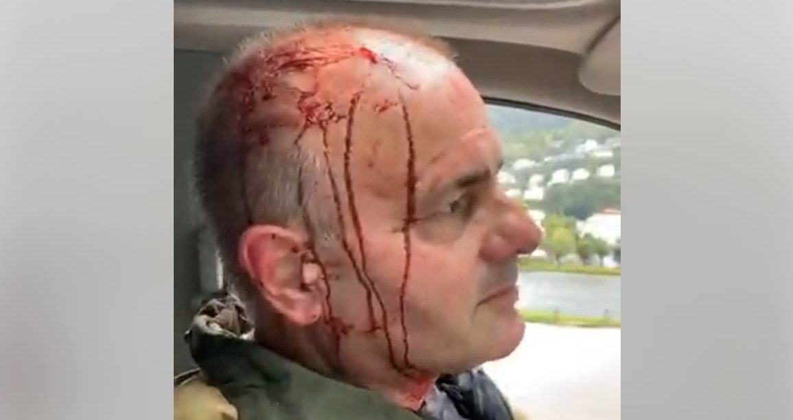 Krenkede muslimer regjerer gatene med vold. Politiet i Bergen: – Som forventet&nbsp;<span>(+)</span>